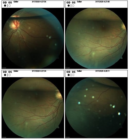 Retinal Review: February 2021 - OOMC