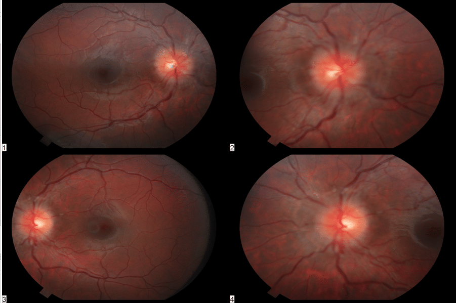 retinal-review-september-2021