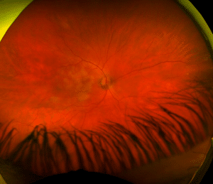 Image of the Eye