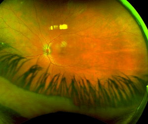 Image of the Eye