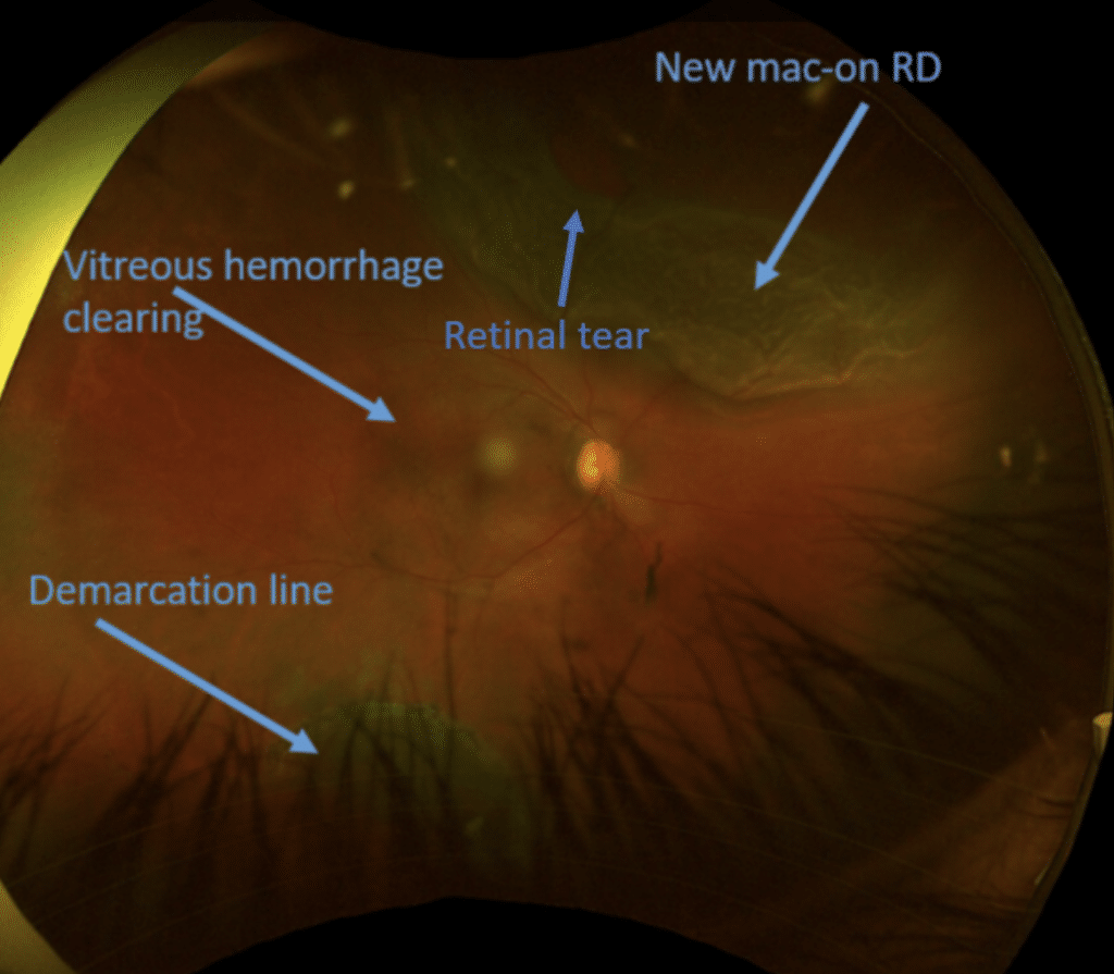 Home Page: Ophthalmology Retina